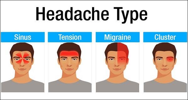 6 Types of Headaches: The Exact Pain Spot Reveals the Cause and ...